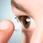 What are Contact Lenses?